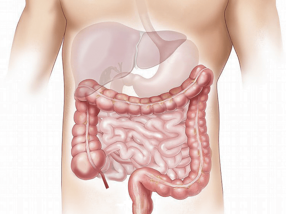 Le gros intestin humain, siège des diverticulites