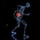 la fibromyalgie