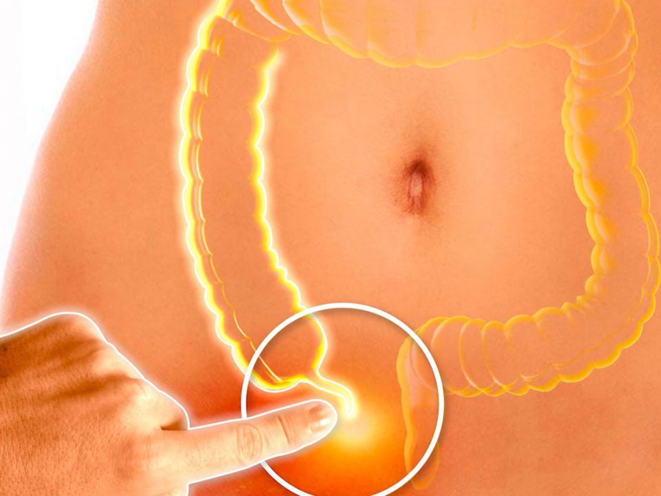 Femme souffrance d'une inflamation de l'appendice
