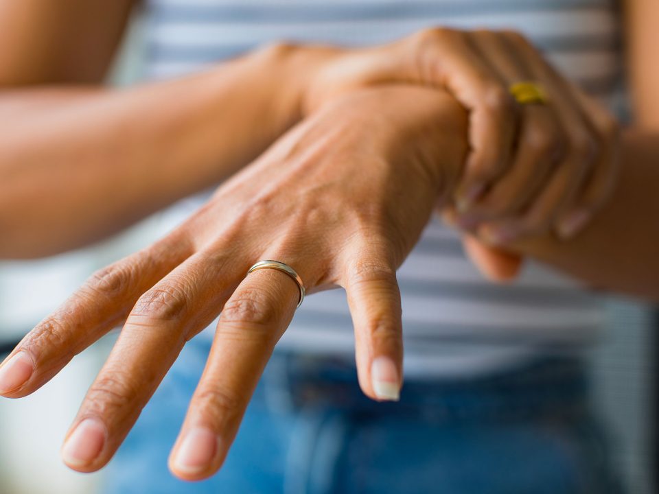 Main de femme paralysée par le Syndrome de Guillain Barré