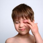 Jeune garçon souffrant d'un Oedème de Quincke avec un oeil très gonflé